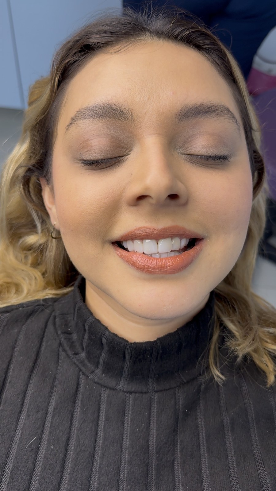 Diseño de Sonrisa - Cierre de Diastema Central & Armonía Facial (Después)